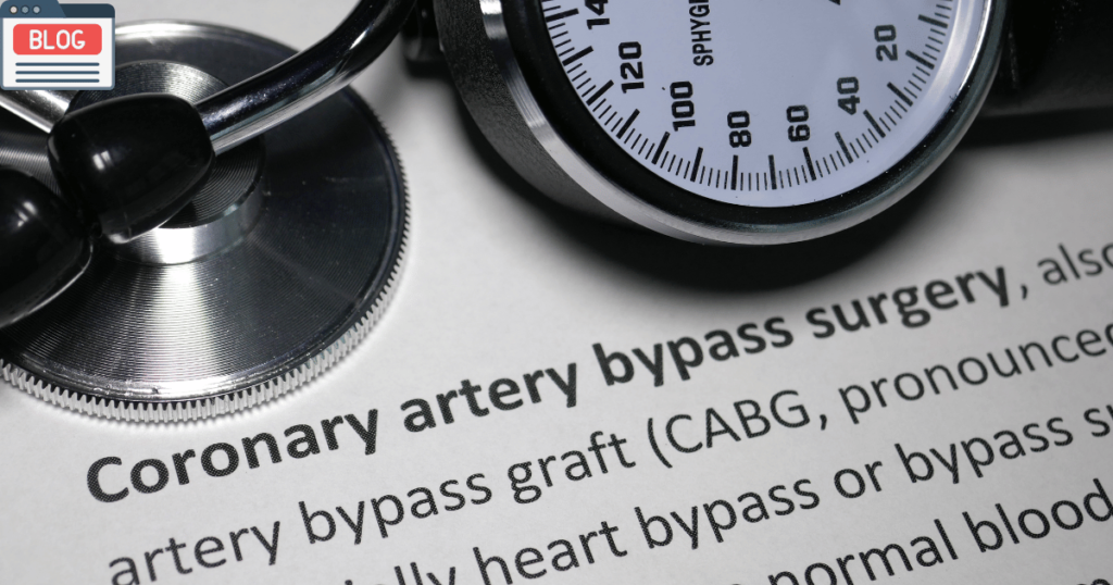 Coronary Artery Bypass Surgery