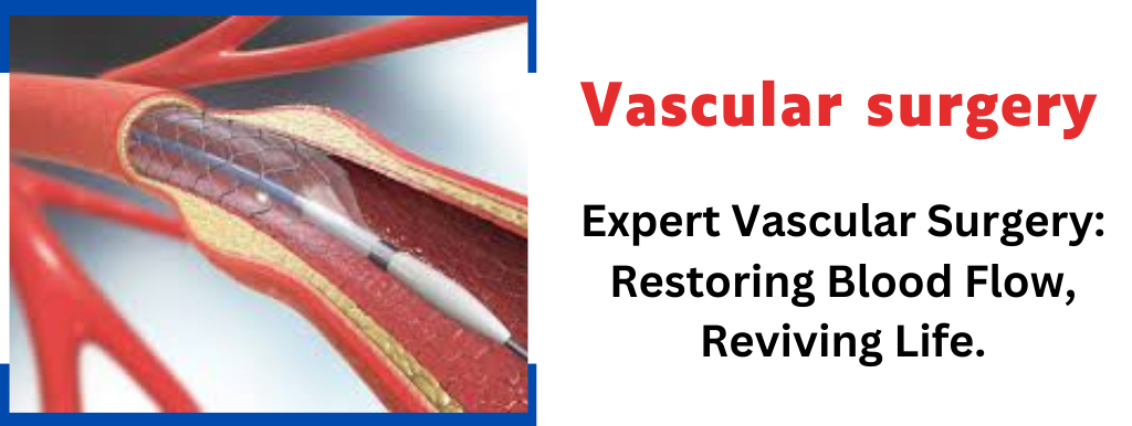 Vascular surgery