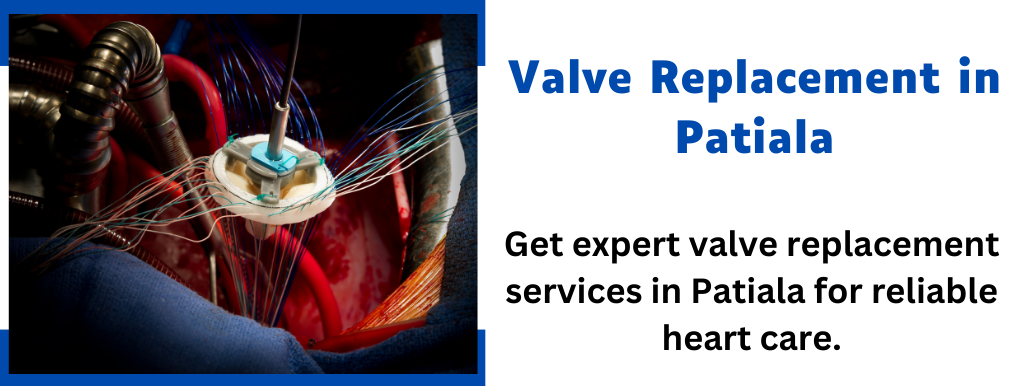 Valve Replacement in Patiala