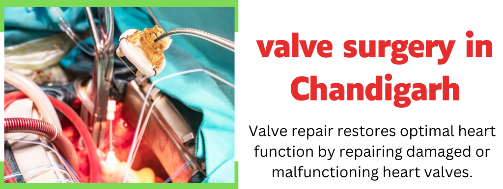 valve surgery in Chandigarh