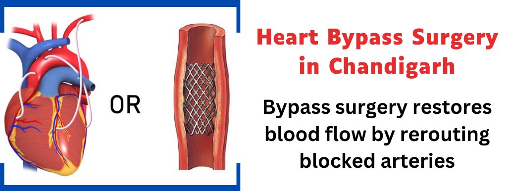 Heart Bypass Surgery in Chandigarh