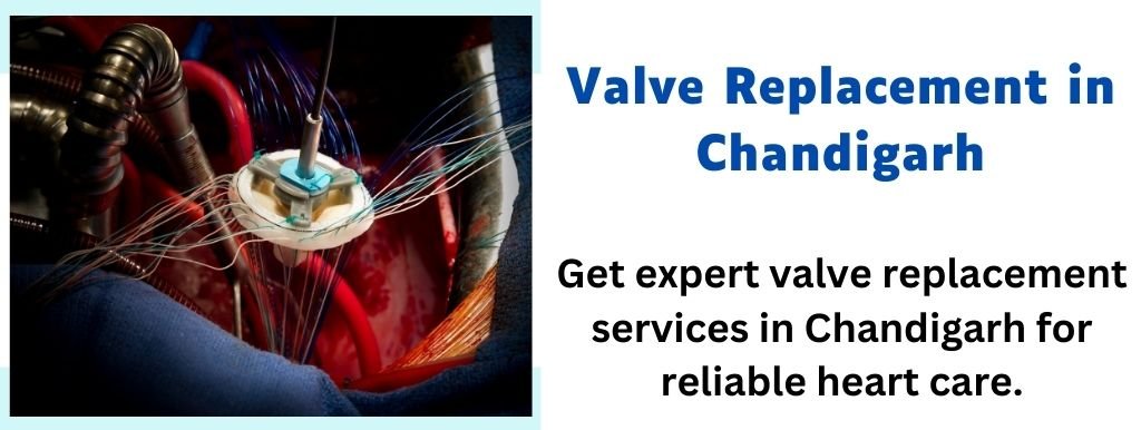 Valve Replacement in Chandigarh