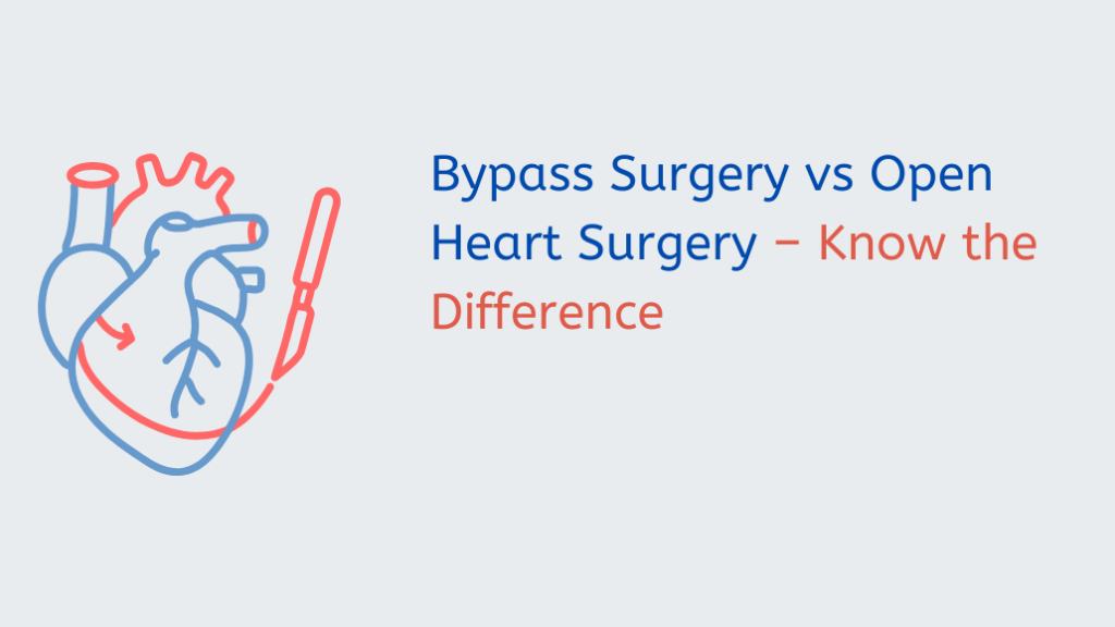 Difference Between Bypass Surgery and Open Heart Surgery